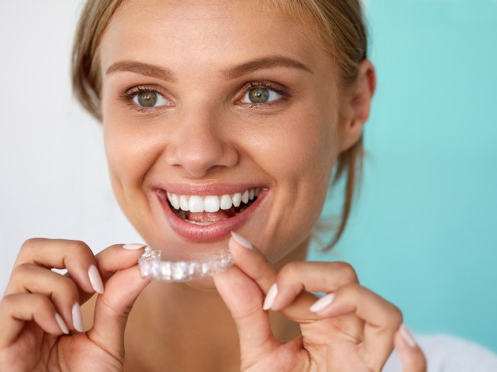 Frau mit schönen, gesunden Zähne hält eine Zahnschiene für Zahnkorrektur in der Hand