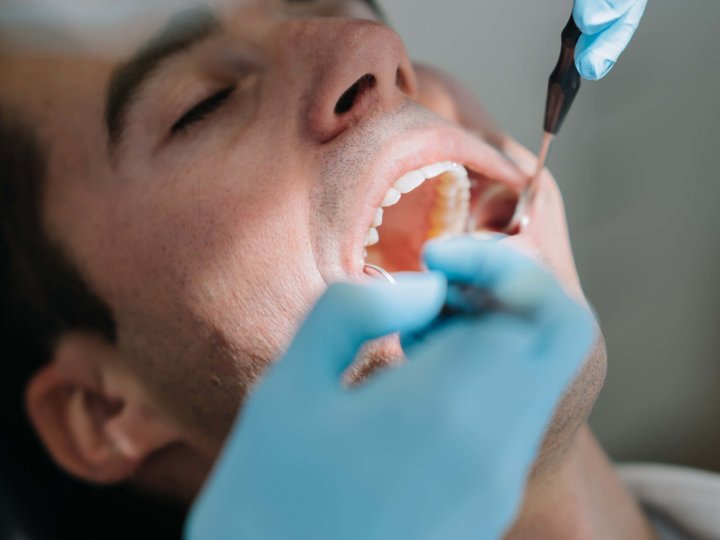 Patient wird mit Instrumenten am Zahn behandelt
